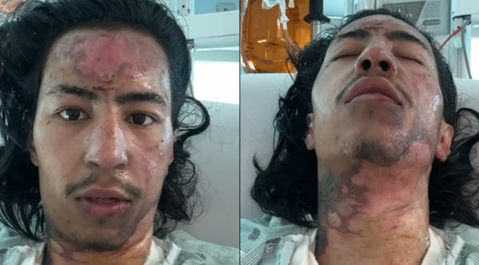 El desarrollador de Solana que se quemó en el truco de Meme Coin está vivo y quiere otro desafío