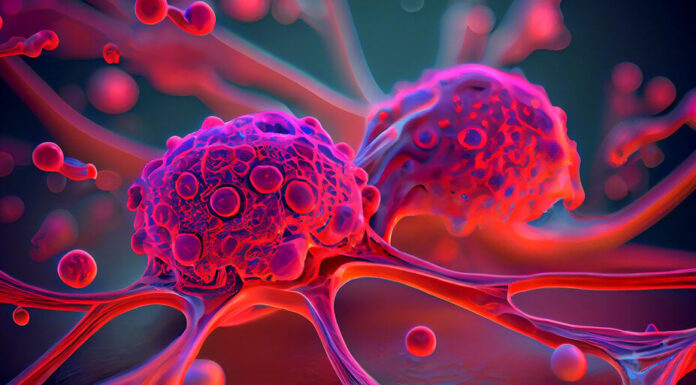 El detector de cáncer con IA cuenta con una precisión del 98 % en 13 tipos, según un estudio