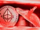 Ethereum Whale arroja $23 millones de ETH a medida que el precio cae